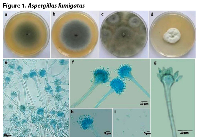 Aspergillus fumigatus